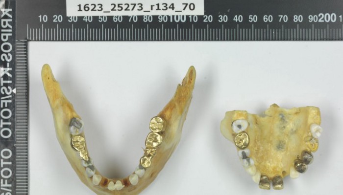 La femme d'Isdal s'est fait faire un travail en or sur ses dents, ce qui n'est pas typique de la dentisterie norvégienne | Kripos
